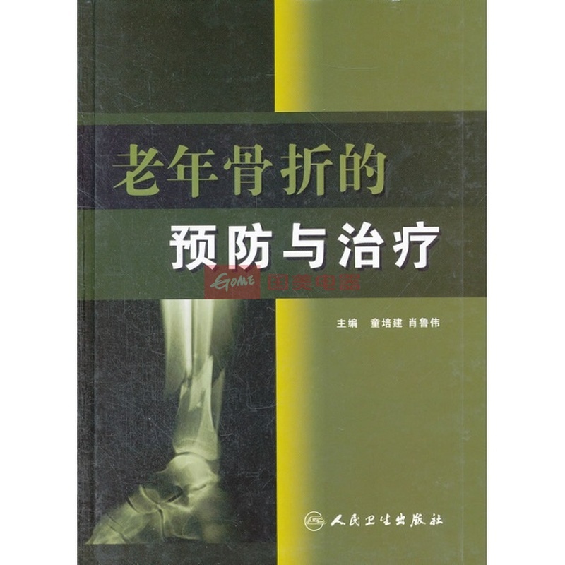 老年性骨折的治疗与预防图片,外观图,细节图